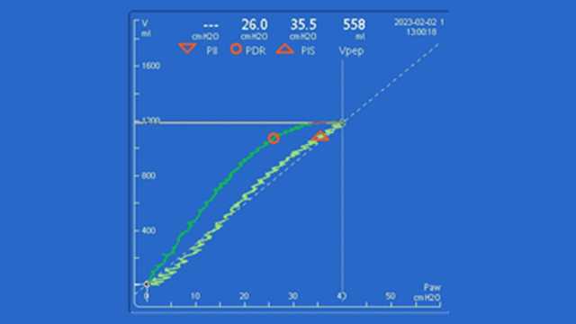 Ponga a prueba su IntelliVence (vol. 20, número 3)
