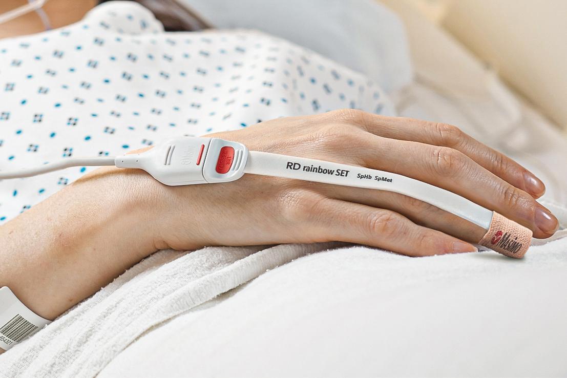 Patient hand with SpO2 sensor