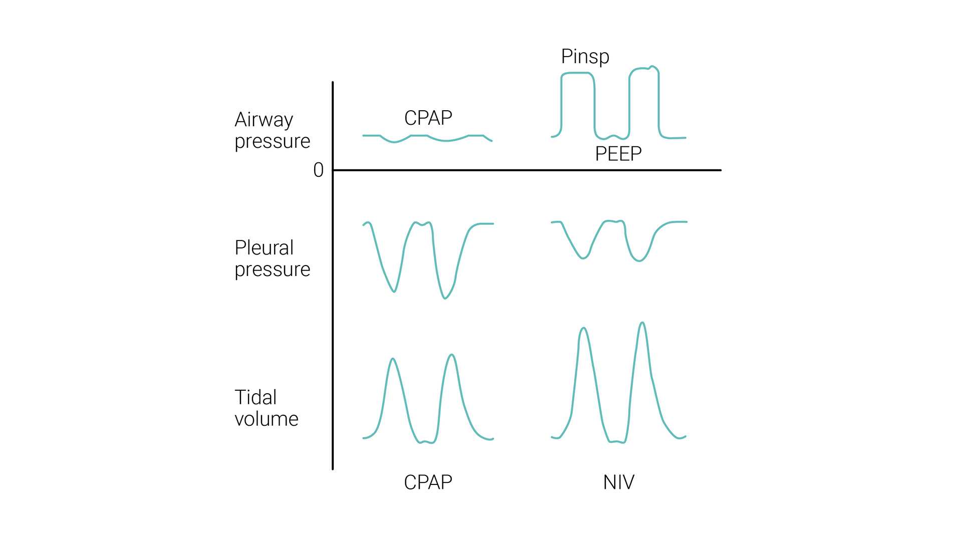 A comprehensive guide to noninvasive ventilation (NIV) | Hamilton Medical