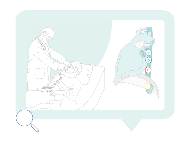 Lineart doctor patient catheter 