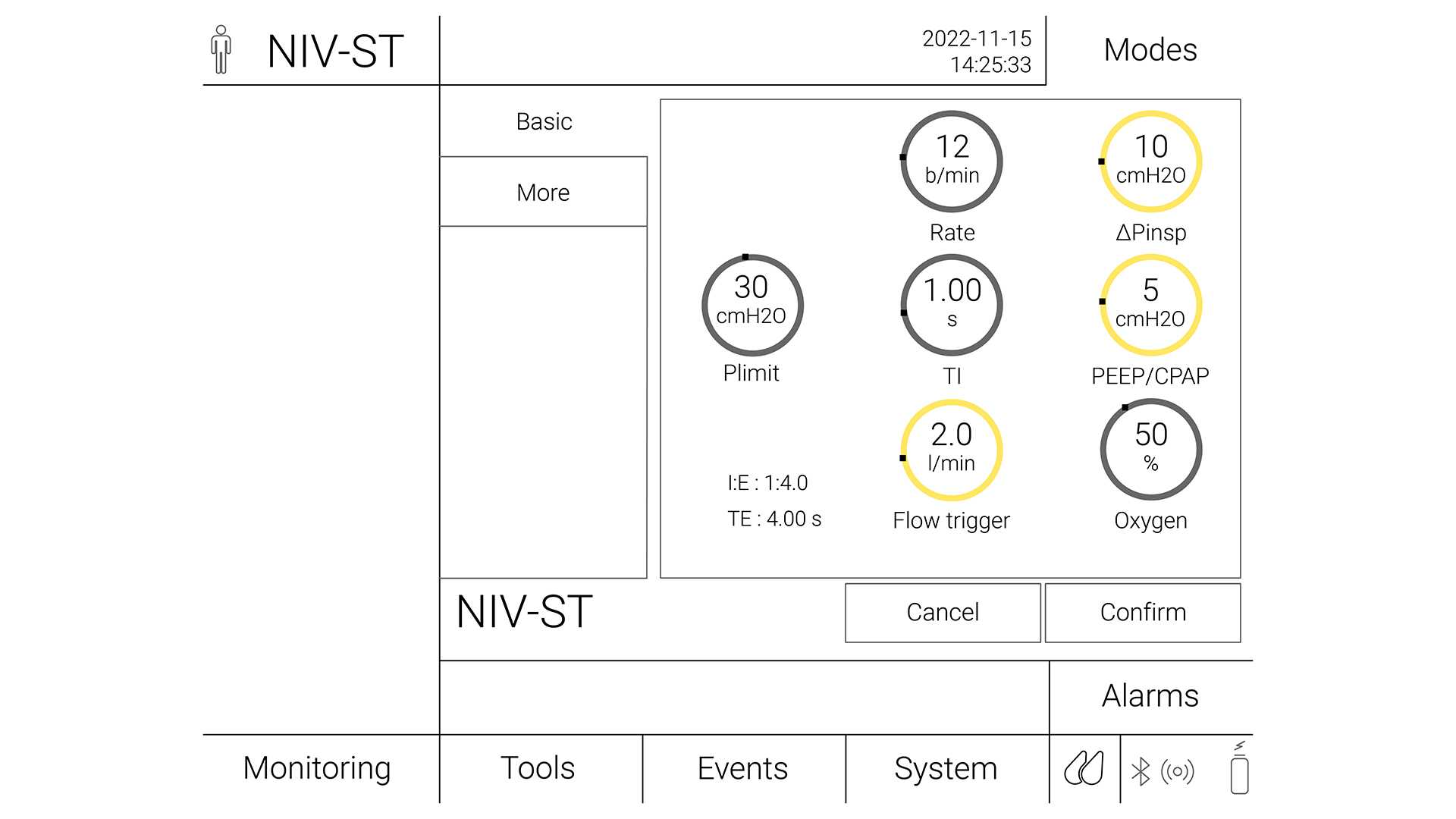 Illustration of a ventilator screen settings for NIV-ST 