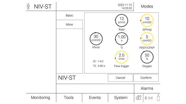 Illustration of a ventilator screen settings for NIV-ST 