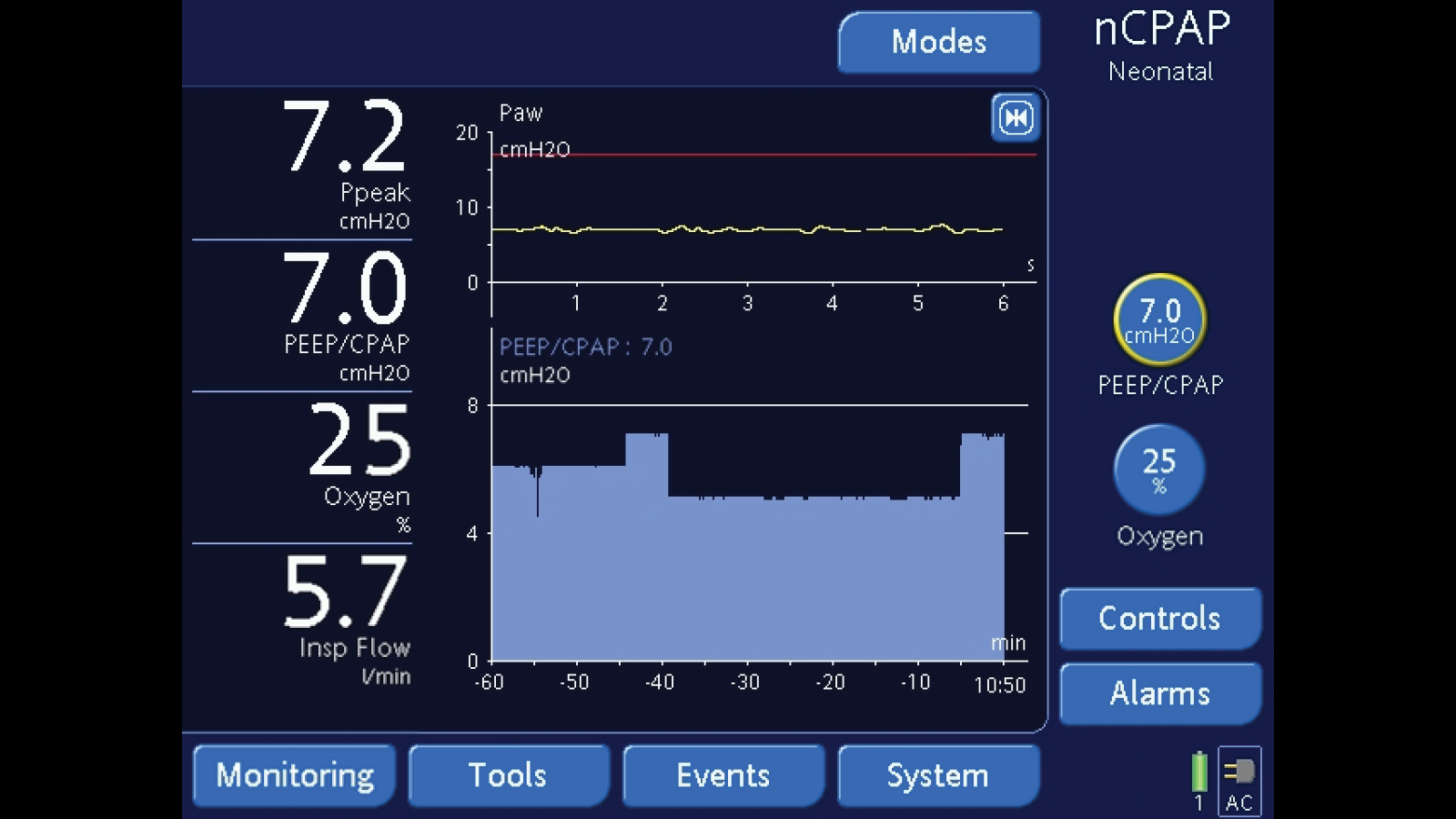 Interfaccia per nCPAP sui nostri ventilatori