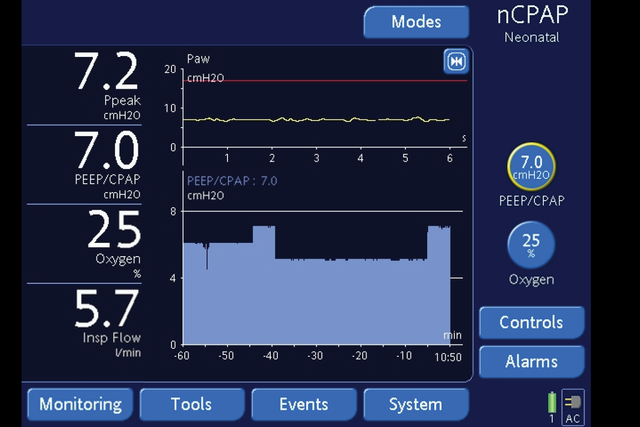 nCPAP interface on our ventilators