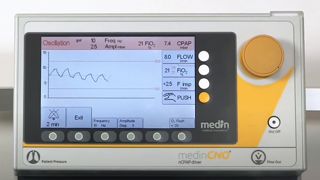 medin_CNO_Oscillation_VM_YT_Thumbnail