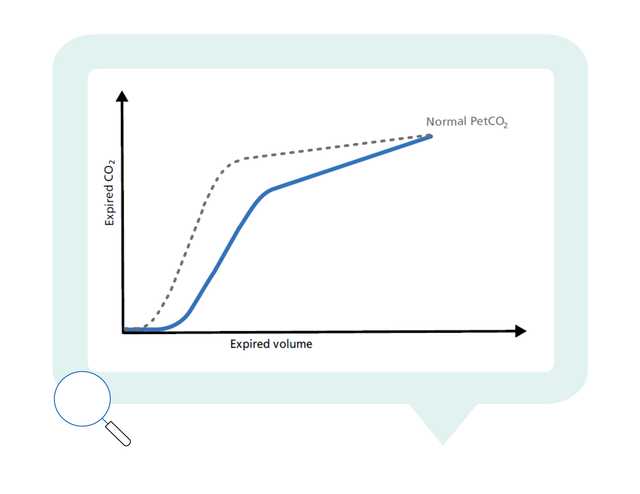 Graph showing normal and actual PetCO2 plotted against expired volume