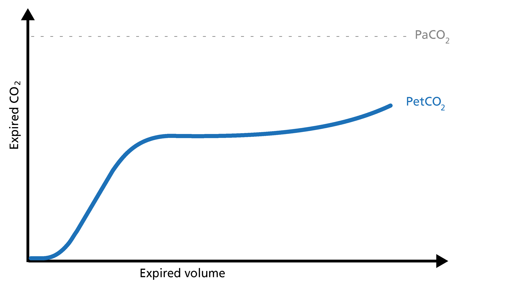 Illustration of a concave volumetric capnogram associated with increased airway resistance