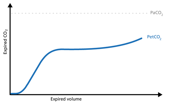 Basics of volumetric capnography - Part 3: Clinical relevance ...