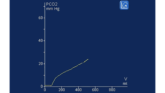 Test your IntelliVence (Vol 16 Issue 2)
