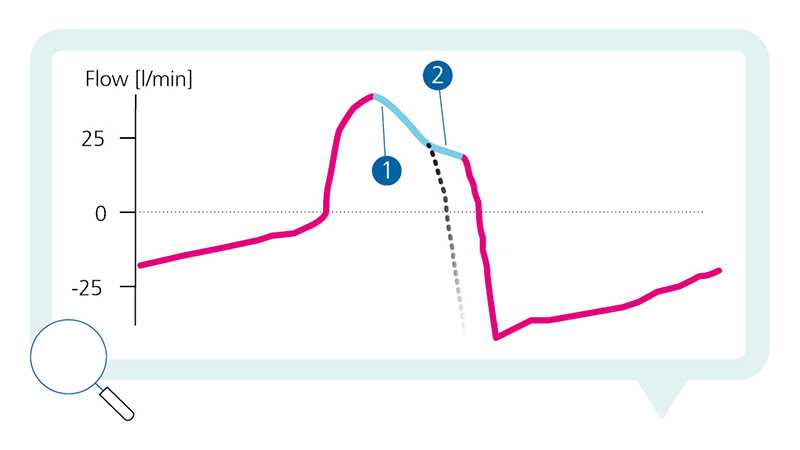 Flow waveform showing fast increase followed by exponential decay