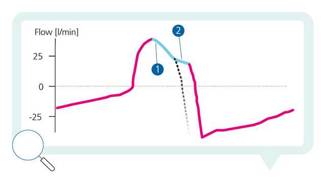What type of asynchrony can you see? #7