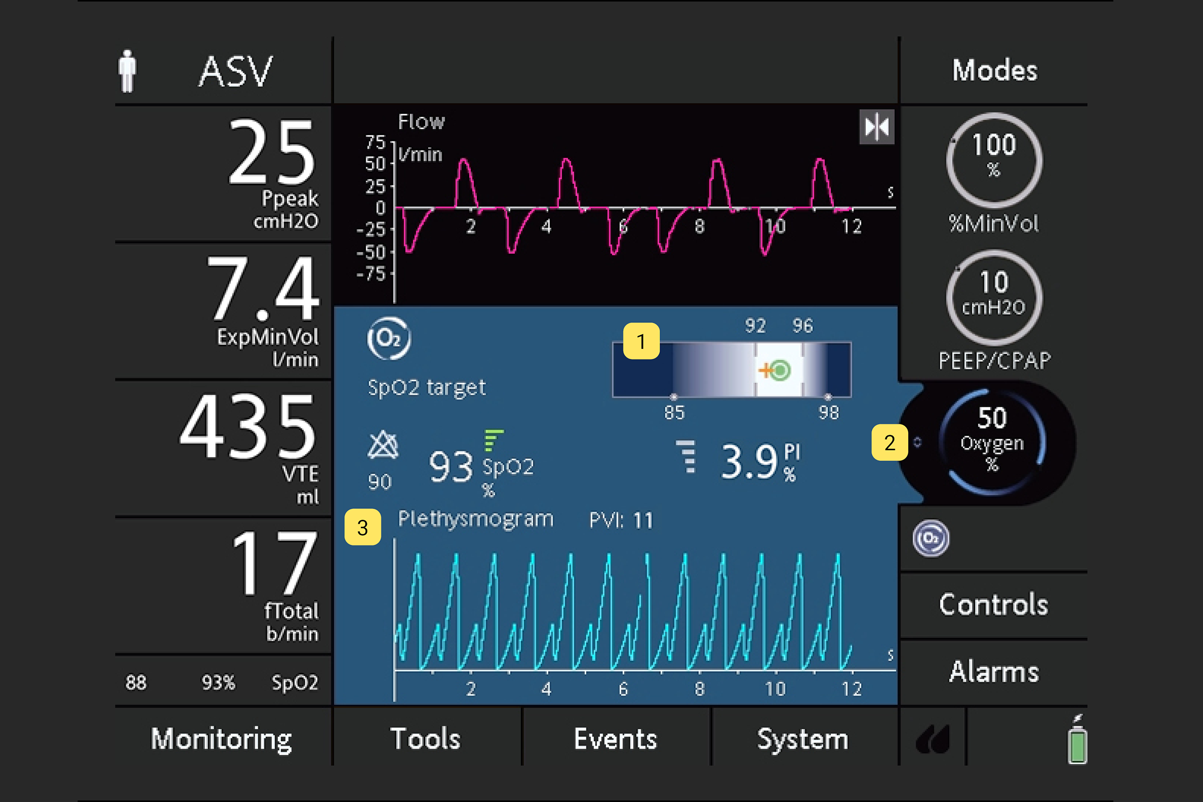 Screenshot of O2 assist on the HAMILTON-C1
