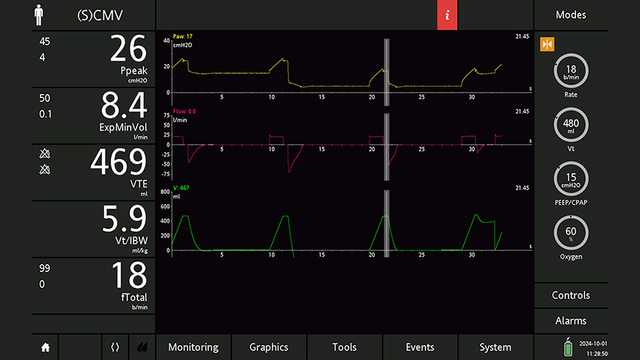 Screenshot with cursor correctly positioned showing values as abovve
