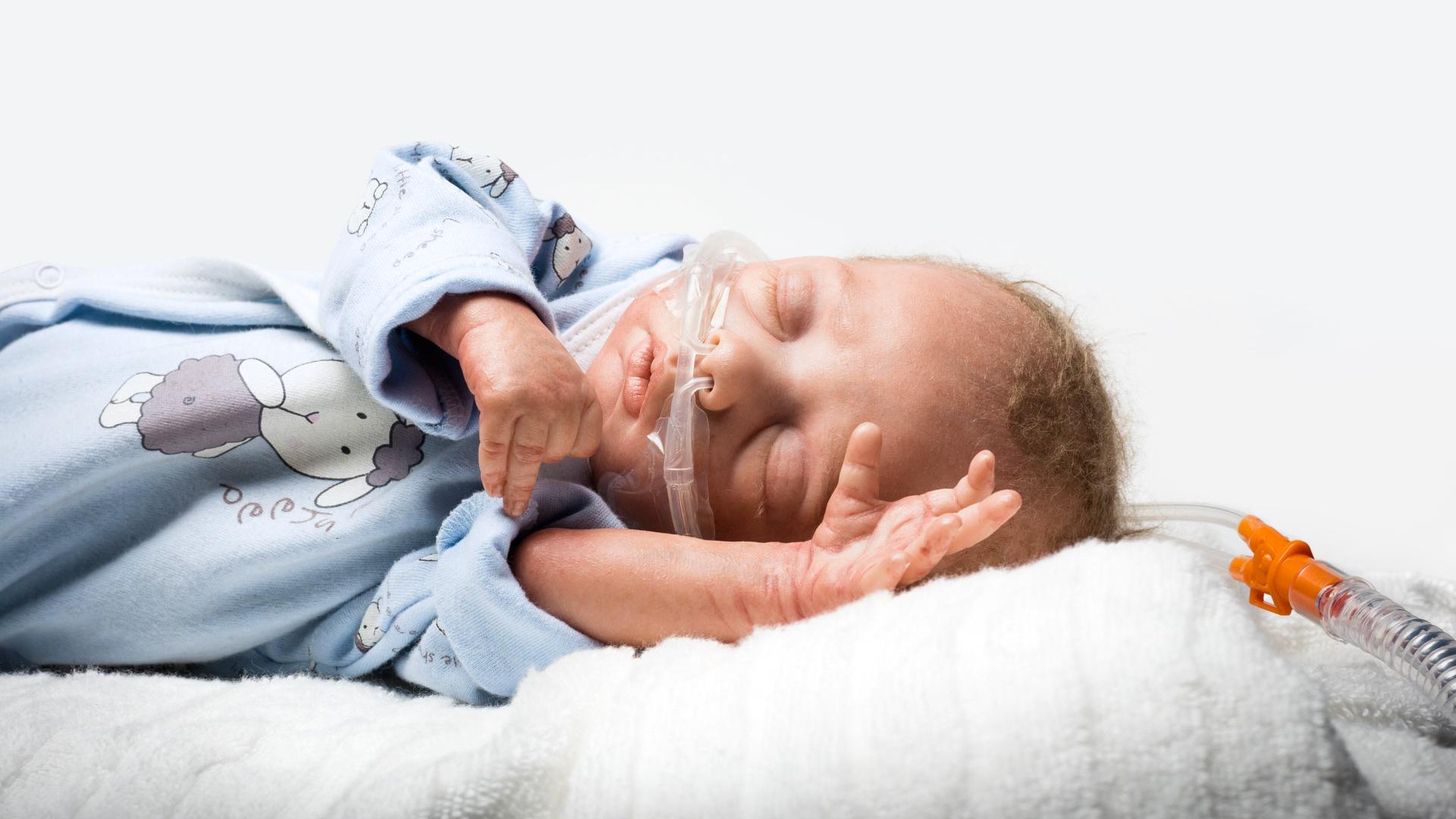 Neonatal patient with Nuflow interface and mother