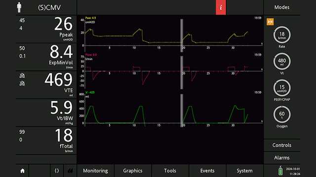 Screenshot showing cursor correctly positioned and corresponding values