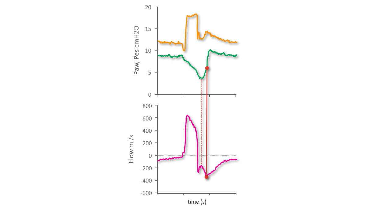 Waveform showing late start of exponential decay