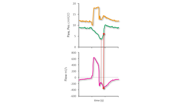 Waveform showing late start of exponential decay