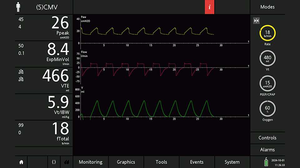 Screenshot of waveforms in SCMV mode with PEEP at 15