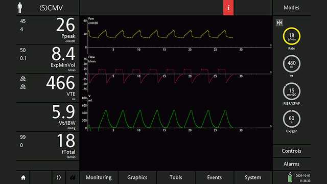 Screenshot of waveforms in SCMV mode with PEEP at 15