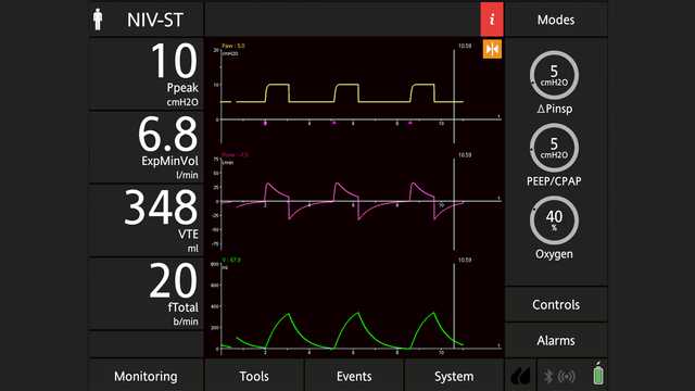 ∆Pinsp setting in NIV-ST