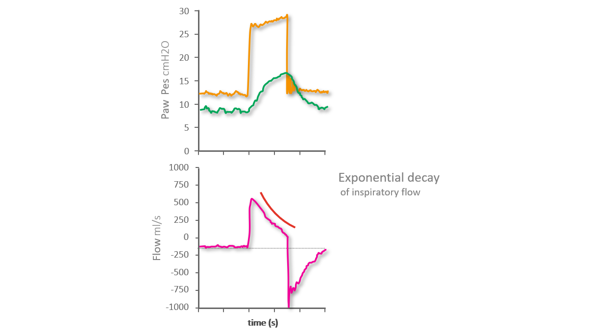 Pes waveform showing no negative deflection