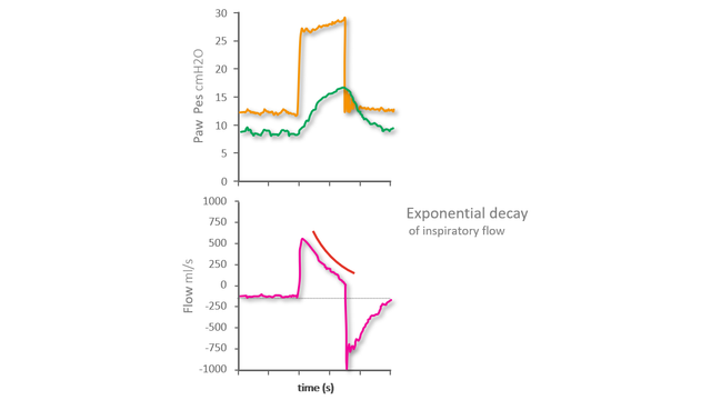 Pes waveform showing no negative deflection