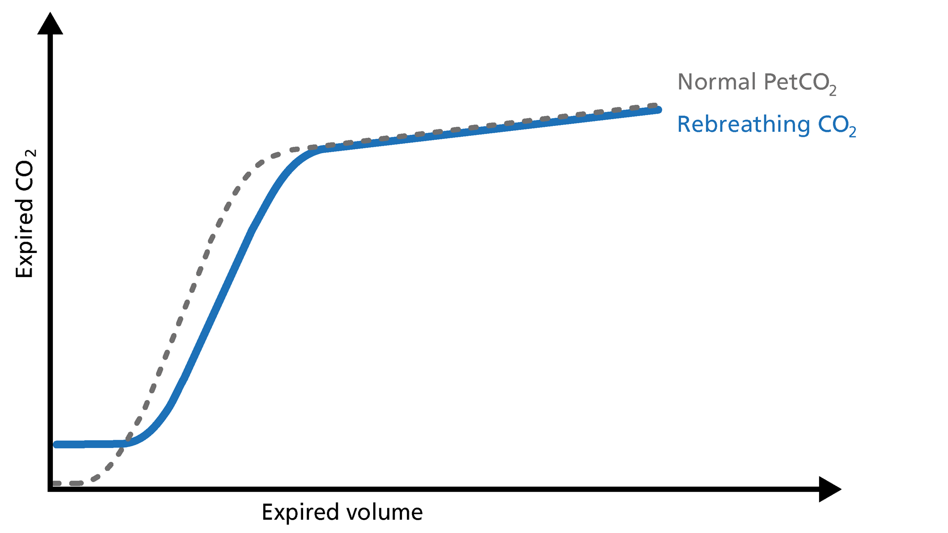 Basics Of Volumetric Capnography - Part 3: Clinical Relevance ...