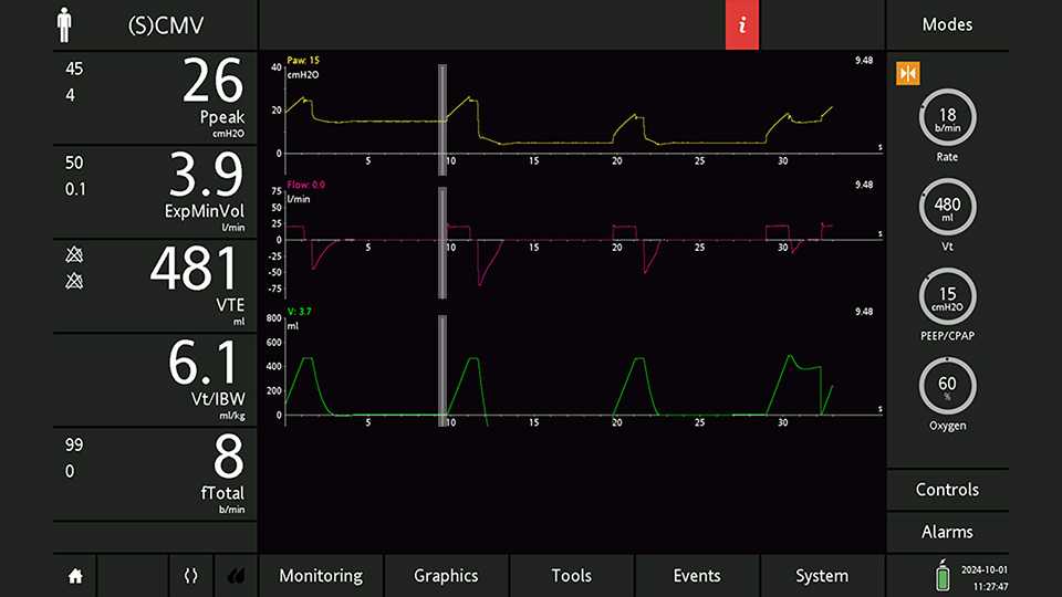 Screenshot showing cursor correctly positioned and Paw of 15