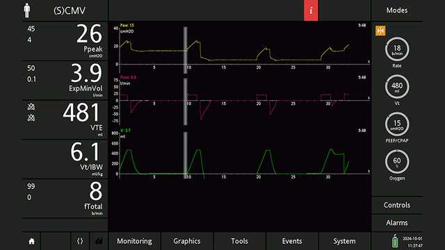Screenshot showing cursor correctly positioned and Paw of 15