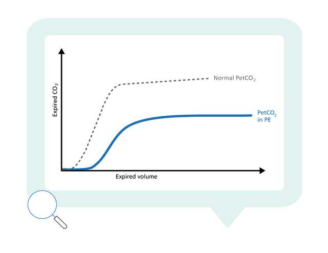 Graph showing normal and actual PetCO2 plotted against expired volume