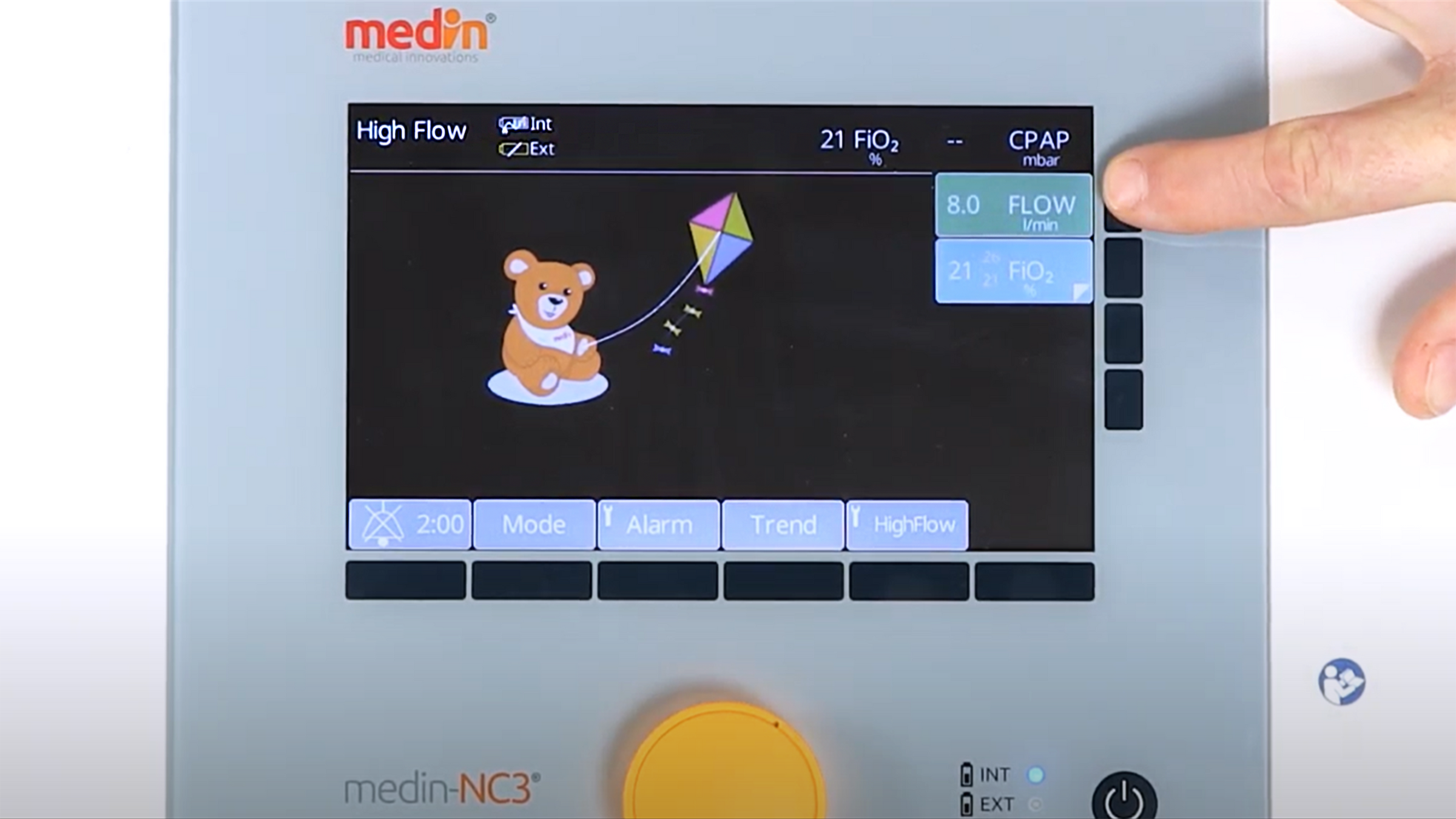 This video describes the high flow mode of our medin-NC3. medin-NC3 is the first turbine-driven CPAP device for non-invasive respiratory support for premature infants and newborns. The high-performance turbine makes the device independent of a fixed compressed air supply.