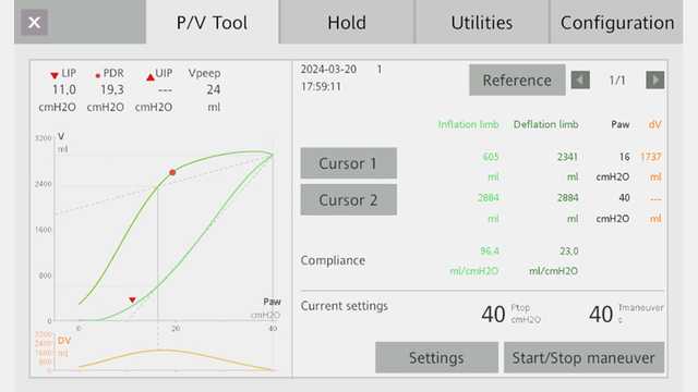 Screenshot showing PV loop with max distance of 1737 and max volume of 2884