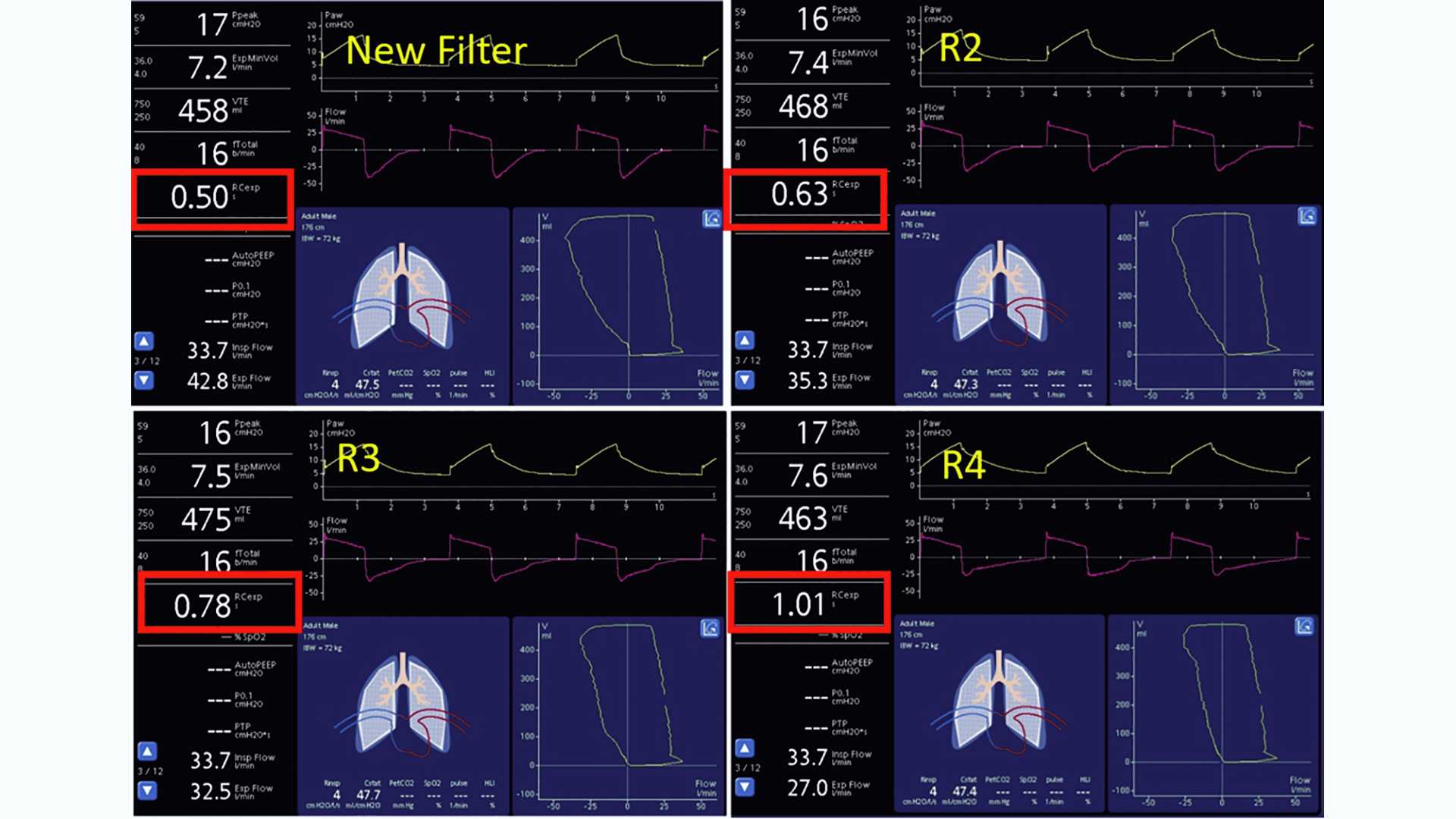 Screenshots showing dynamic lung and monitoring parameters