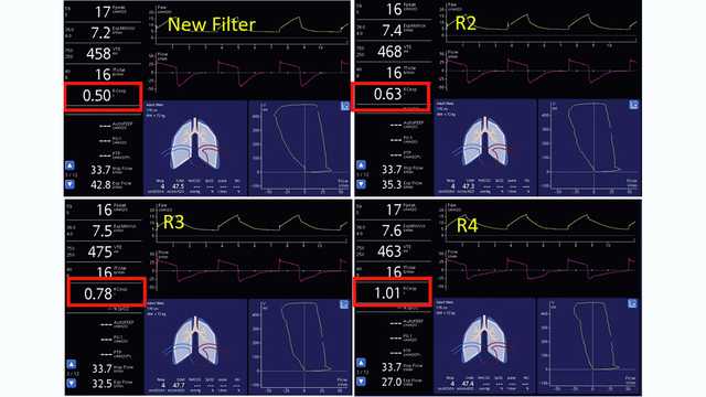 Screenshots showing dynamic lung and monitoring parameters