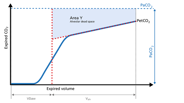 Illustration of the Area Y of the volumetric capnogram