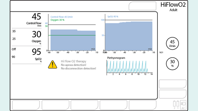 Image : interface affichant des paramètres de monitorage