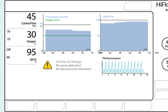Graphic illustration: interface showing monitoring parameters