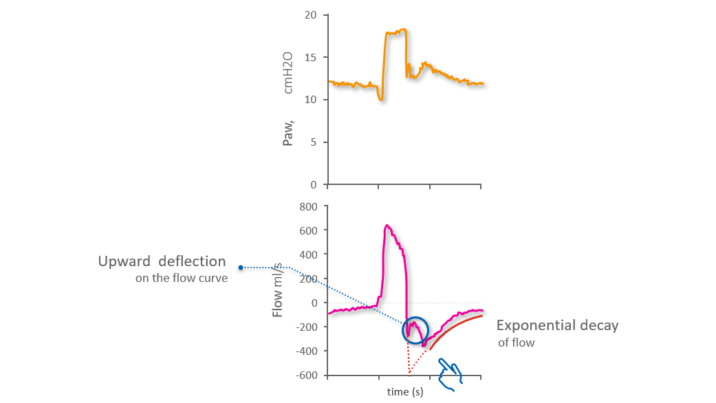 Waveform showing upwards deflection