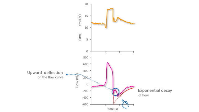 Waveform showing upwards deflection