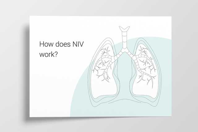 Illustration for the chapter "How does NIV work?"
