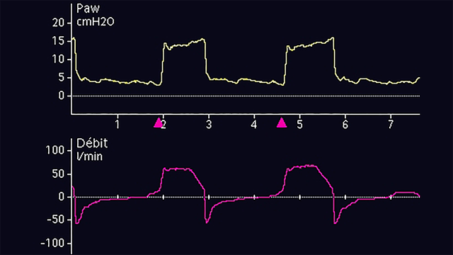 Test your IntelliVence (Vol 21 Issue 2)