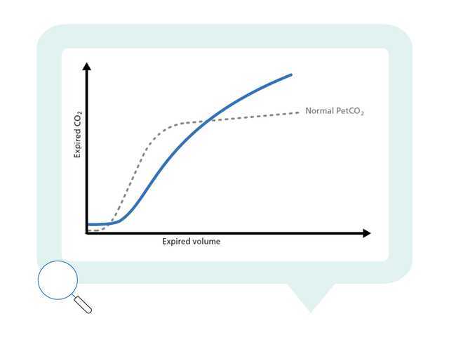 Graph showing normal and actual PetCO2 plotted against expired volume