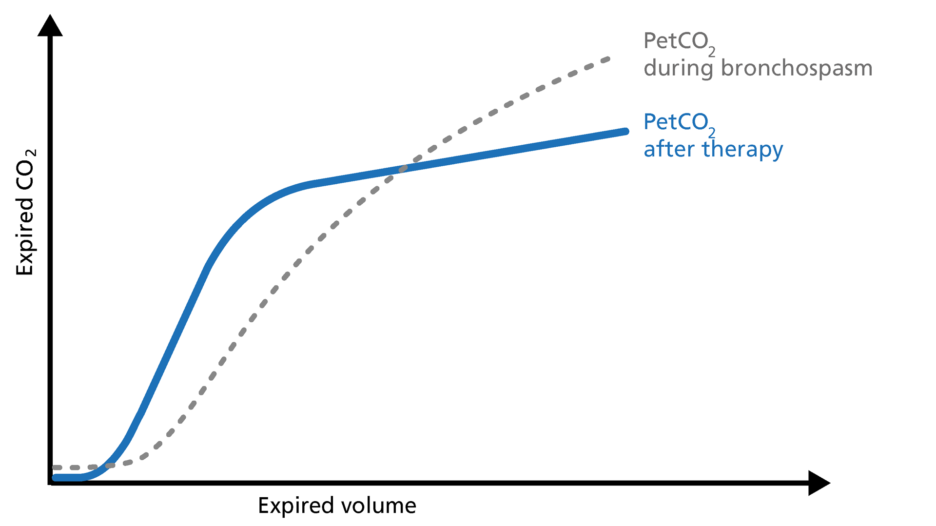 Illustration of PetCo2 in COPD patients after therapy on a volumetric capnogram
