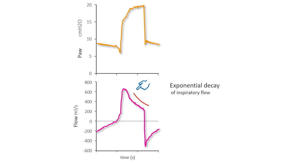 Flow waveform showing prolonged exponential decay
