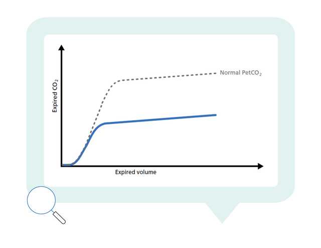 Graph showing normal and actual PetCO2 plotted against expired volume