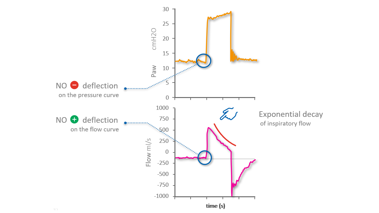 Flow and pressure waveforms showing no patient activity