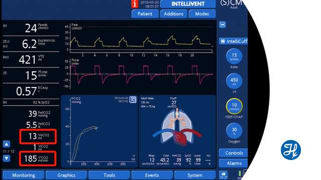 Using volumetric capnography to set PEEP