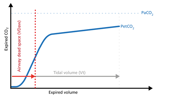 Illustration of the dead space ventilation on the volumetric capnogram