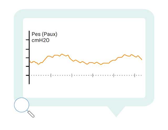 Diagram representing esophageal pressure waveform