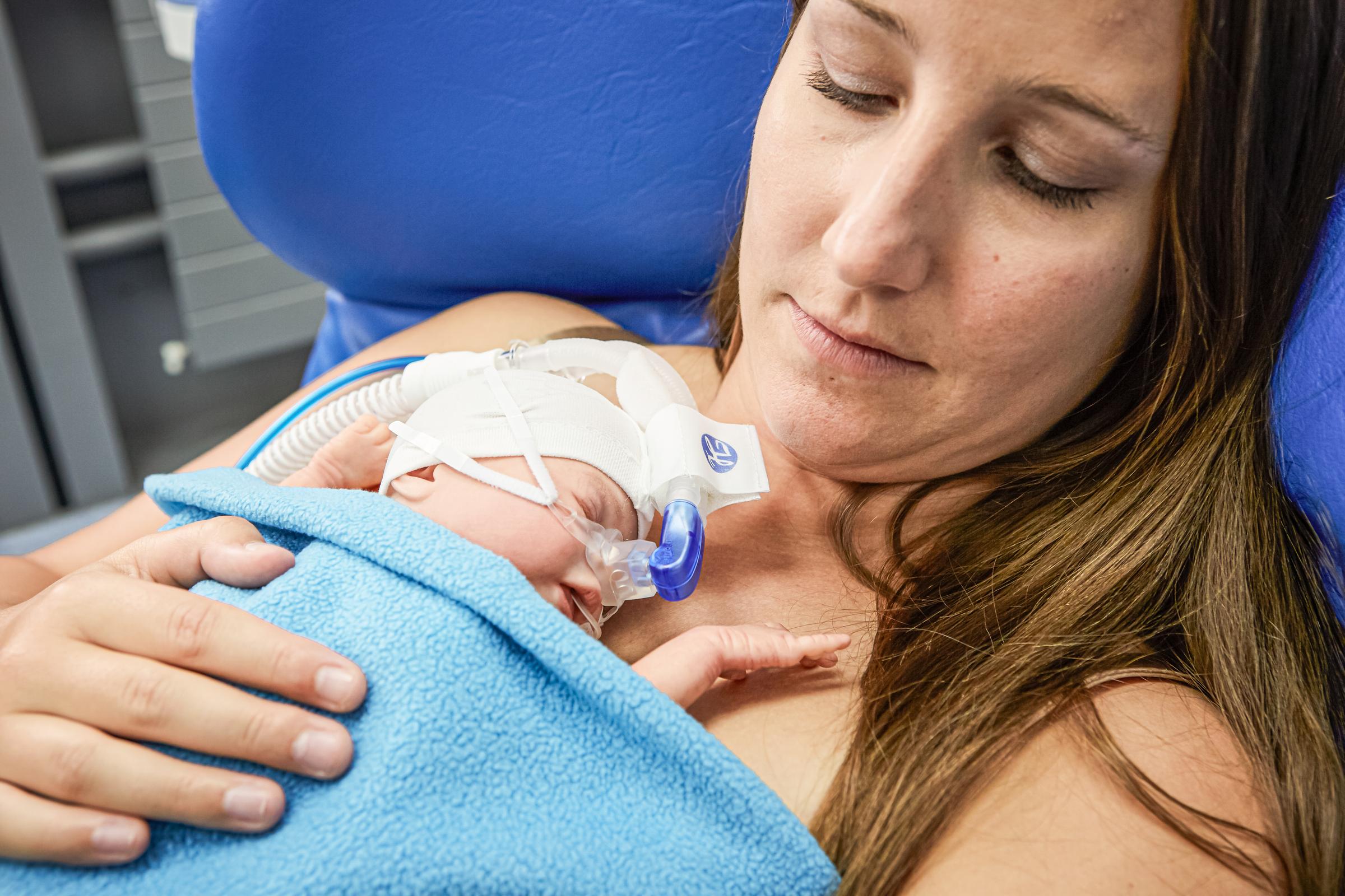 Neonato con interfaccia per nCPAP